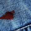 How to Remove Blood Stains from Jeans