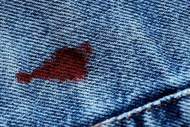 How to Remove Blood Stains from Jeans